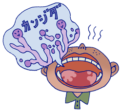 口の中のカビ カンジダ菌